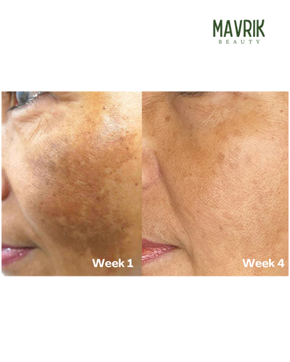 Aboriginal Turmeric & Kojic Acid Brightening Soap – Erases Dark Spots & Scars Fast