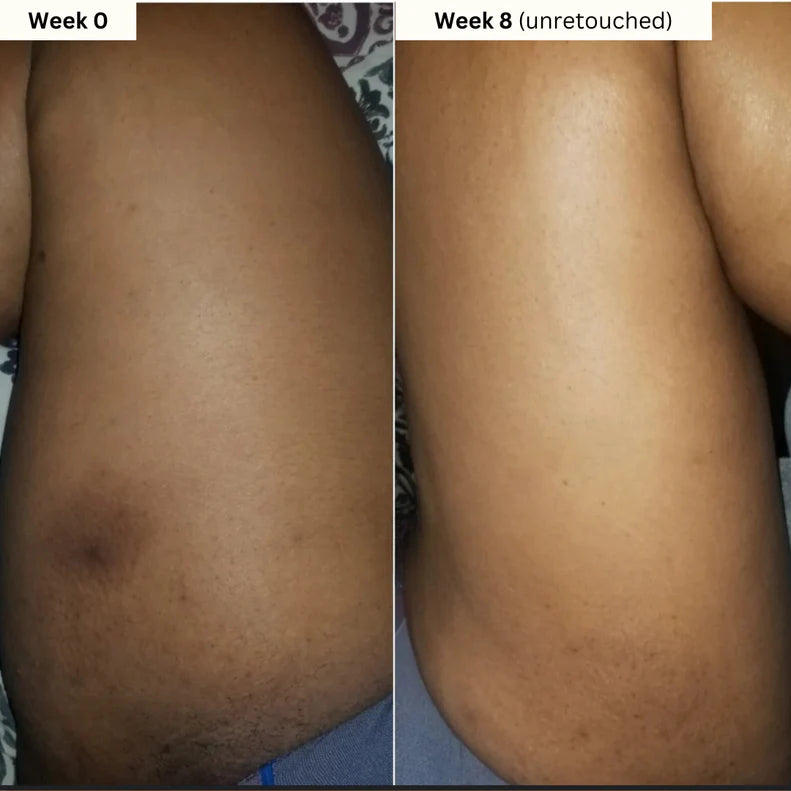 Aboriginal Turmeric & Kojic Acid Brightening Soap – Erases Dark Spots & Scars Fast