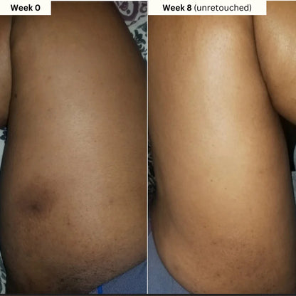 Aboriginal Turmeric & Kojic Acid Brightening Soap – Erases Dark Spots & Scars Fast