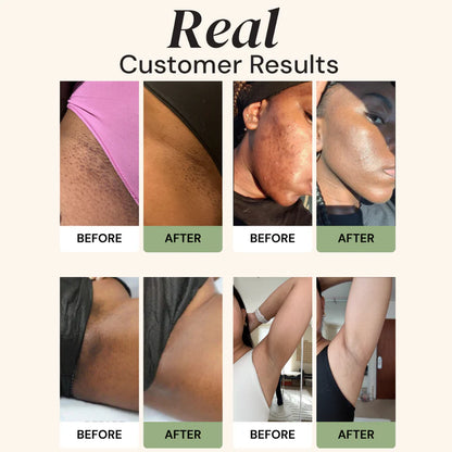 Aboriginal Turmeric & Kojic Acid Brightening Soap – Erases Dark Spots & Scars Fast